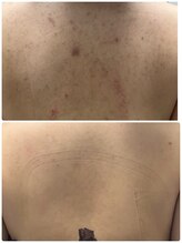 リクラ 北千住(Reclat)/