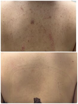 リクラ 北千住(Reclat)/