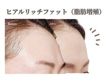 ベラ 東京院(Bella)の雰囲気（エステでは叶わなかった顔の脂肪コントロール【小顔/肌質改善】）