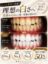 博多ホワイトニング福岡 小倉駅前店&nbsp;ホワイト BeforeAfer