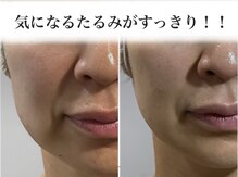 サロンドボーテ ベル(SALONDEBEAUTE BELLE)