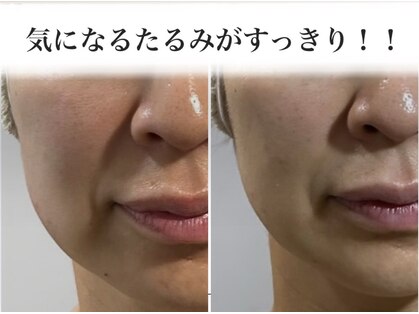 サロンドボーテ ベル(SALONDEBEAUTE BELLE)の写真