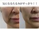サロンドボーテ ベル(SALONDEBEAUTE BELLE)の写真
