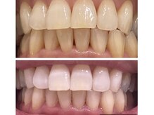 ホワイトアイ 谷町四丁目(WHITE EYE)/ホワイトニング