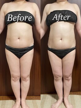 ヴィム(VIM)/ハイパーナイフビフォーアフター