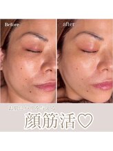 セレン(Seren)/気になる(たるみ)にハリを与える