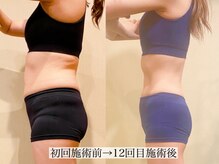 アンジー(Angie)/憧れのペタンコお腹