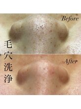 アース コアフュールボーテ 新潟紫竹山店(EARTH coiffure beaute)/毛穴洗浄