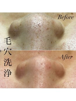 アース コアフュールボーテ 新潟紫竹山店(EARTH coiffure beaute)/毛穴洗浄