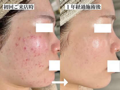 ワイドット(Ydot.)の写真