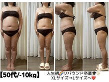 フォルスボーテ(Force Beaute)の雰囲気（脂肪分解導入★10ml 9800円 リンパ/温活/ダイエット/人気店/痩身）