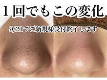 アンドピエル(AndPiel)