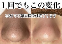 アンドピエル(AndPiel)