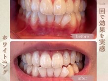 ラナ(LaNa)/一回でもこの効果！！