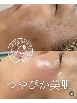 エクセレントビューティーサロン 艶(EN)/即効性！シミケア・トーンアップ