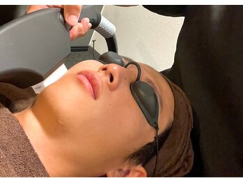 メンズアルファ/ヒゲ脱毛でガラッとイメチェン!