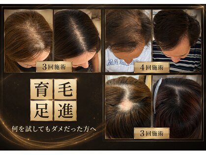 カナウ睡眠頭皮研究ラボ【7/3 NEW OPEN（予定）】の写真