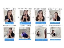 ホワイトニングショップ 新潟店/ホワイトニングやり方の一連