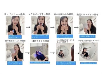 ホワイトニングショップ 新潟店/ホワイトニングやり方の一連