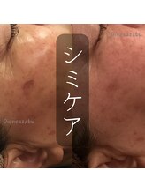 ディオーネ 麻布十番(Dione)/【シミケア】