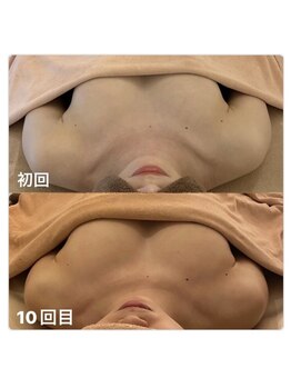 ベッピン(Beppin)/バストアップ／筋膜リリース