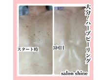 サロンシャイン(Salon Shine)の雰囲気（≪メンズフェイシャル≫プライベート空間でご気軽にお悩み相談◎）