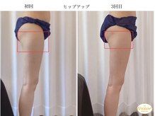 トレゾール(tresor)/★痩身★赤坂痩身エステ