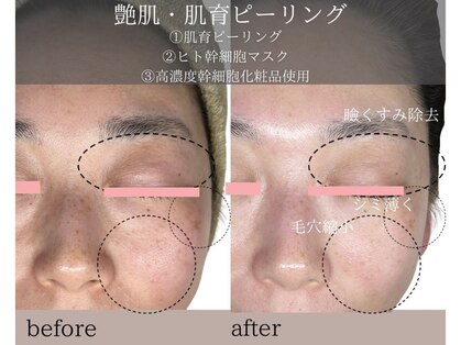 シェリーボーテ(Shelly beaute)の写真