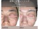 シェリーボーテ(Shelly beaute)の写真