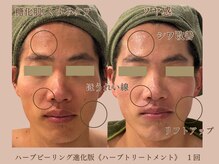 シア(Shia)の雰囲気（[メンズ]ただ肌をキレイにするだけじゃない。顔の印象も変える）