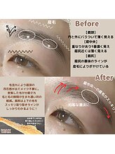 ミスズ(MISUZU)/眉レシピ～HBL～