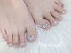 ヒポ ネイル(Hippo Nail)の写真/★角質・巻爪ケアもあります★ケアしながらジェルネイルが出来ます♪巻爪矯正1本¥1500~