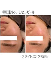 モイ(moi.)/◆セラピール◆