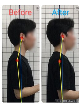 ボディメイク整体院 横浜駅西口店(BodyMake)/施術風景-背中がつらい20代男性-