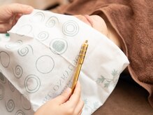 女性に嬉しい美容鍼灸もご用意