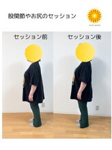 スパークル/股関節の前部に痛みを感じるE様