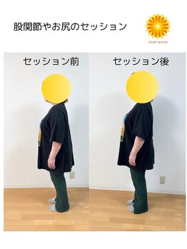 スパークル/股関節の前部に痛みを感じるE様