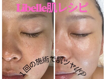 リベレ(Libelle)の写真