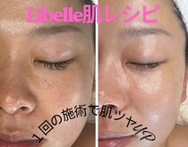 リベレ(Libelle)