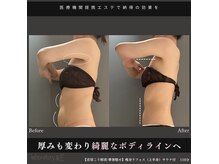 ハリQ治療院 麻布十番の雰囲気（１回でも効果が分かる！ラフォスプロ・痩身・麻布エステ）