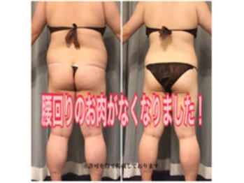 ボディエステティック アクアオーラ 富山店/腰回りがスッキリ！