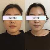 小顔革命 心斎橋