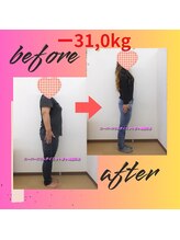 スーパースリムダイエット茅ヶ崎 茅ヶ崎整体院/4ヵ月－３１ｋｇ減ダイエット♪