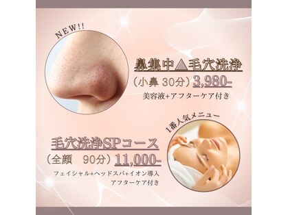 アンベリーの写真