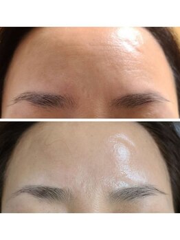 ビハダ(BeHADA)/#全顔シワ改善#毛穴#赤み