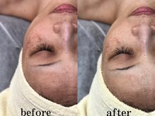 フィノアンド(feino&...)/【エステメニュー】