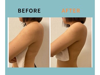 ディーメヴィ(D.MAVIE)/二の腕＆背中痩せ