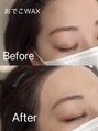 ビューティーサロンバース(Beauty Salon Birth)&nbsp;おでこwax♪オプションメニューになってます！waxで産毛も綺麗に