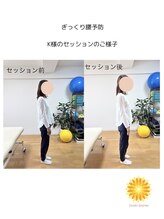 スパークル/反り腰や腰の痛みを感じるK様