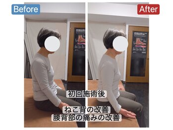 アンティオール 札幌店/70代女性　慢性腰痛
